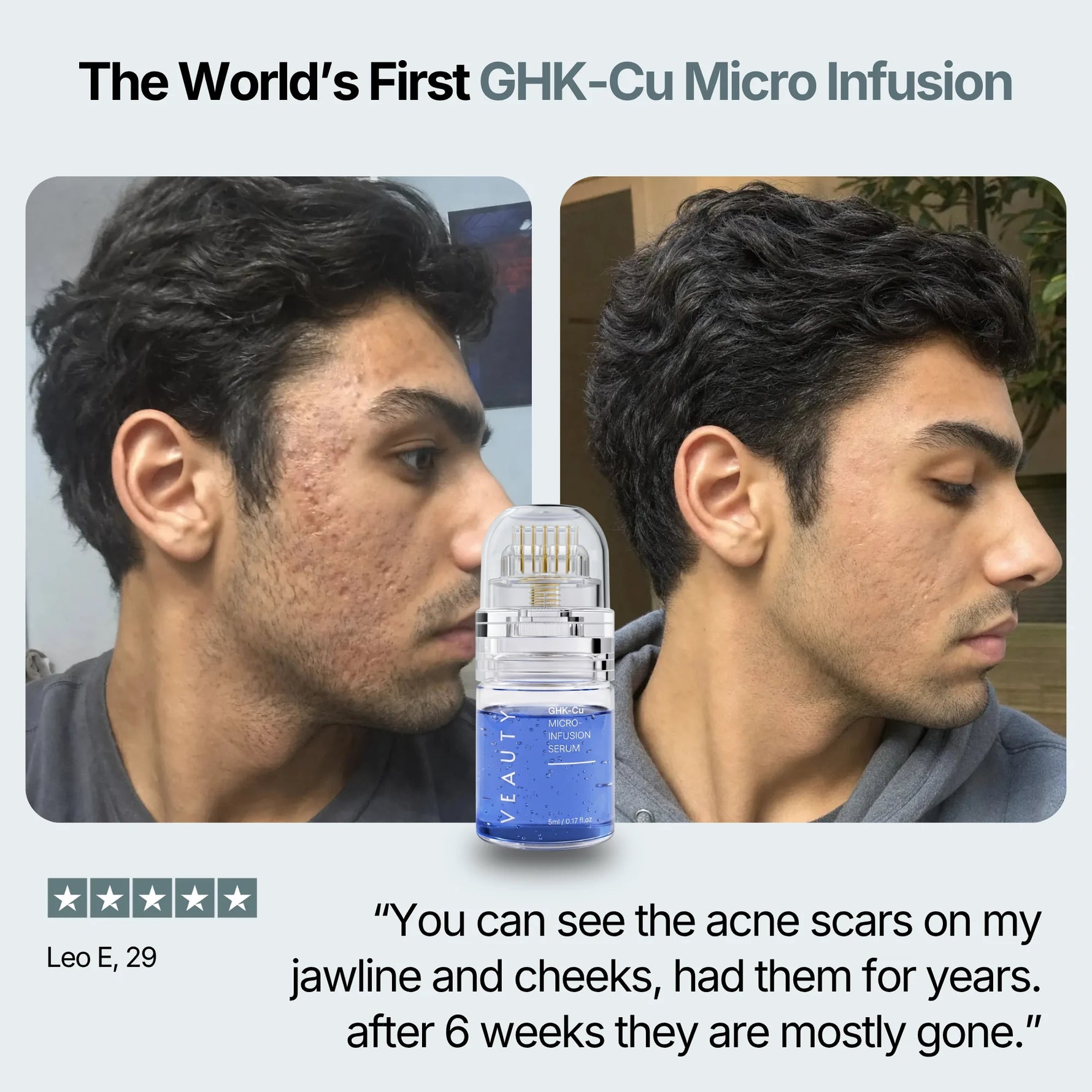 does ghk cu help with jawline Revitalize Your Skin: The Benefits of Copper Peptide for Youthful Glow How to Use GHK-Cu Peptide