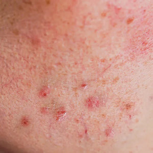 GHK-Cu Micro-Infusion – VEAUTY