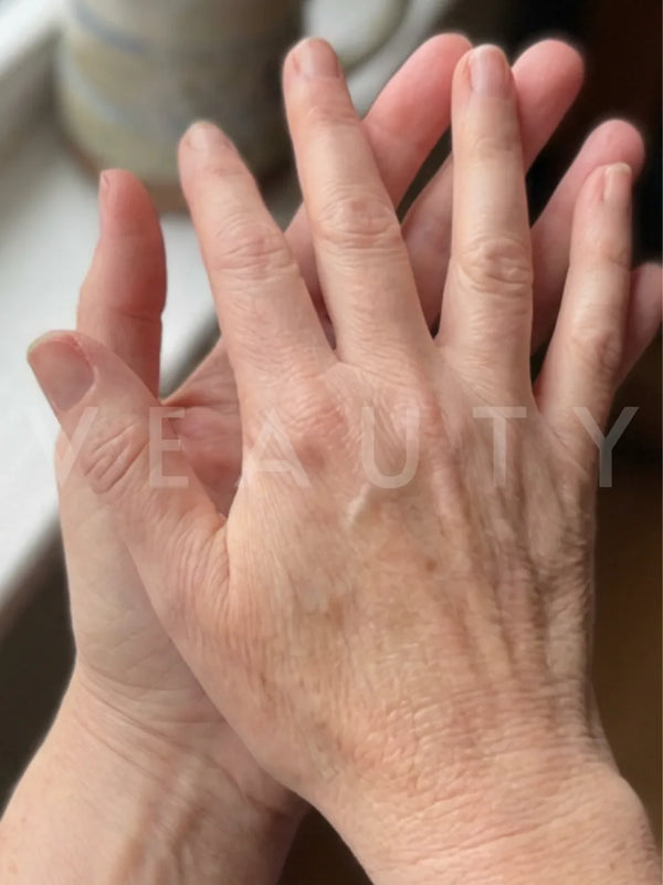 Sanchel, 49