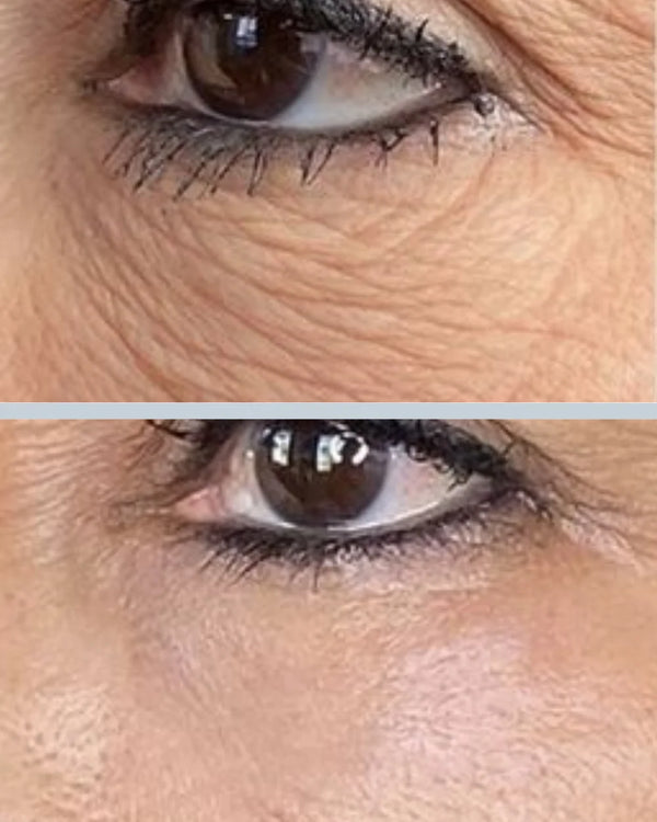 Susan E. result